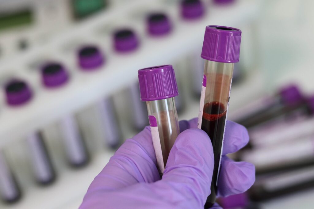 Carnivore diet blood test results